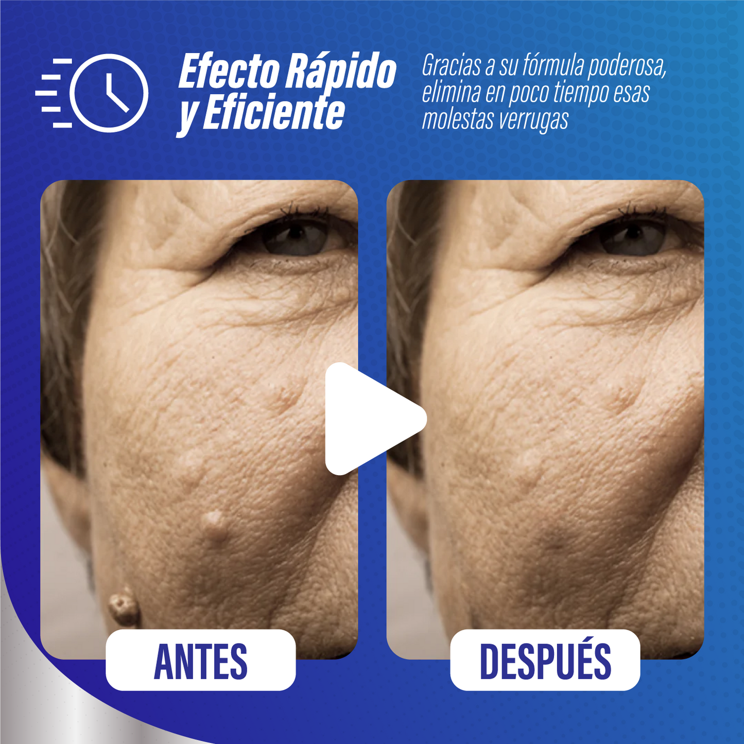 WARTOFF® - ELIMINA LAS VERRUGAS Y RECUPERA TU CONFIANZA